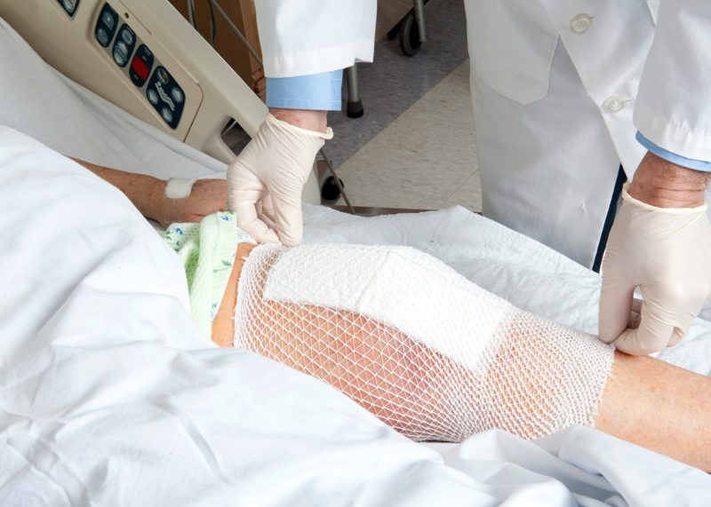 Patient-receiving-wound-care-and-dressing-for-the-knee-after-surgery